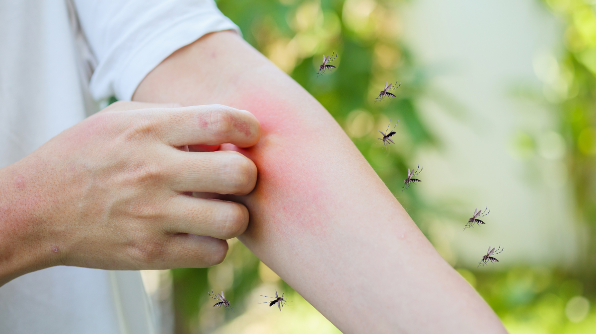 Tabasco suma 647 casos de dengue
